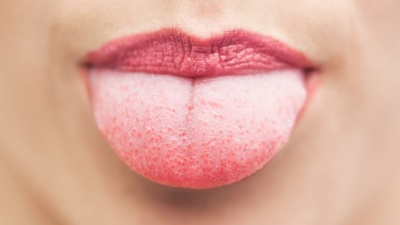 Езикът може да говори много за здравето ни