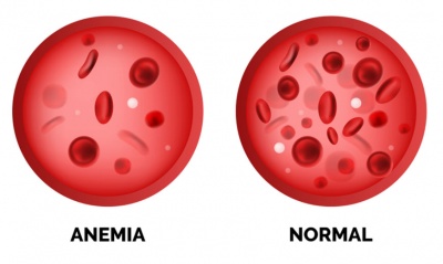 Важността на желязото за човешкото тяло е голяма