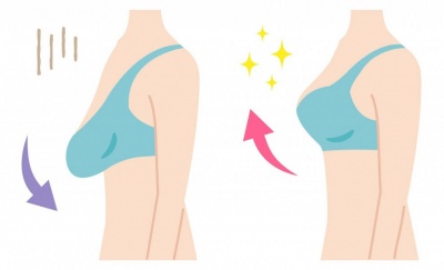 Как да стегнем гърдите естествено?