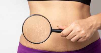 Стриите - как да ги предотвратим?