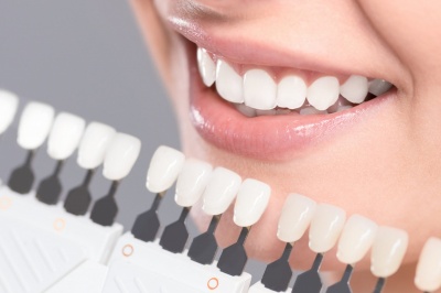 По-бели зъби в домашни условия - как?