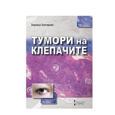 ТУМОРИ НА КЛЕПАЧИТЕ / TUMORI NA KLEPACHITE