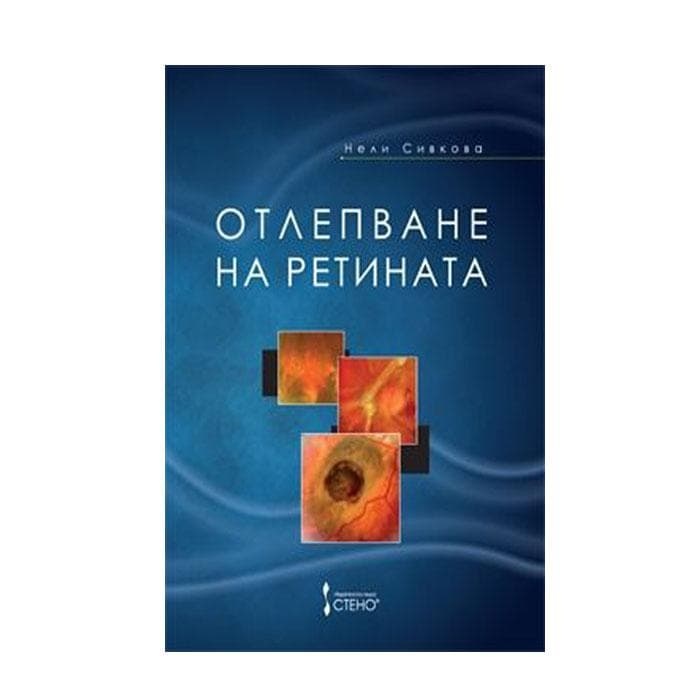 ОТЛЕПВАНЕ НА РЕТИНАТА - НЕЛИ СИВКОВА / OTLEPVANE NA RETINATA - NELI ...