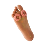 БЕРКЕМАН ПРЪСТЕНИ ЗА БОЛЕЗНЕНИ ЗОНИ 6 броя / BERKEMANN CALLUS PROTECTION RING 