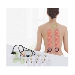 ЕЛЕКТРИЧЕСКИ ВЕНДУЗИ КОМПЛЕКТ 24324 / VERK GROUP ELECTRIC CUPPING SET 24324