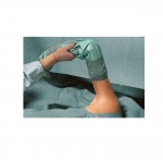 ХАРТМАН АРТРОСКОПСКИ СЕТ ЗА РАМО ПРОТЕКТ ПЛЮС / HARTMANN FOLIODRAPE ARTHROSCOPY SET SHOULDER PROTECT PLUS