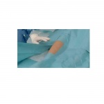 ХАРТМАН ОПЕРАЦИОНЕН СЕТ ПРОТЕКТ ЗА ЗАТВАРЯНЕ НА РАНИ / HARTMANN FOLIODRAPE SET WOUND CLOSURE PROTECT