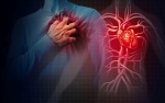 Мъжете или жените са по-склонни към сърдечен удар?