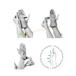 ОРТОТЕХ ОРТЕЗА ЗА РЪКА СТАНДАРТ V ЛЪЧ M / ORTHOTEH HAND ORTHOSIS STANDARD M