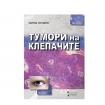 ТУМОРИ НА КЛЕПАЧИТЕ / TUMORI NA KLEPACHITE