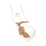 ВАРИТЕКС ОРТЕЗА ЗА ПАЛЕЦА НА КРАКА ПРИ ХАЛУКС ВАЛГУС модел 511 / VARITEKS THUMB FOOT SUPPORT HALLUX VALGUS model 511
